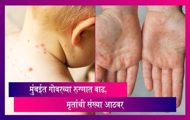 Measles Outbreak In Mumbai: मुंबईत गोवरच्या रुग्णात वाढ, मृतांची संख्या आठवर