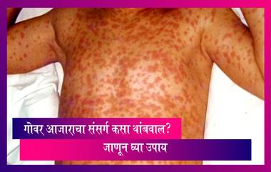 Measles Outbreak In Mumbai: गोवर आजाराचा संसर्ग कसा थांबवाल? जाणून घ्या 6 महत्त्वाचे उपाय