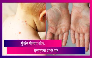 Measles outbreak in Mumbai: मुंबईत गोवरचा उद्रेक, रुग्णसंख्या शंभर पार! केंद्रीय आरोग्य मंत्रालयाकडून विशेष सूचना जारी