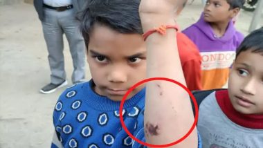 UP Horror: दोनचा पाढा न आल्याने शिक्षकाने मुलाच्या हातावर चालवली ड्रिल मशीन; Kanpur मधील धक्कादायक घटना