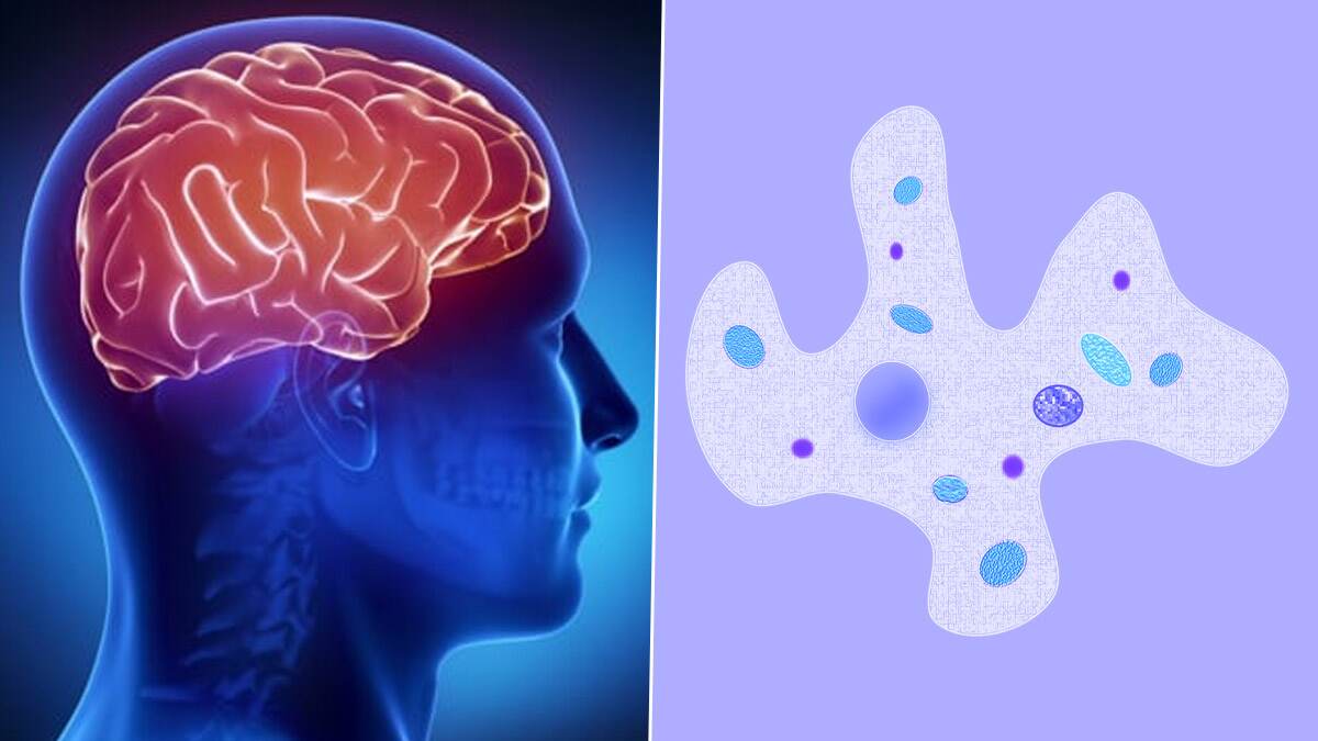 Brain-Eating Amoeba: कोरोनानंतर मेंदू खाणारा अमिबामुळे जगभरात भीतीचे वातावर; संसर्गामुळे दक्षिण कोरियात एकाचा मृत्यू, काय आहे या आजाराची लक्षणं? जाणून घ्या