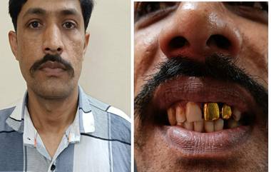 Mumbai Police & Gold Plated Teeth: सोन्याचा दात लावून लपला तरीही, मुंबई पोलिसांनी पकडला 15 वर्षे फरार आरोपी