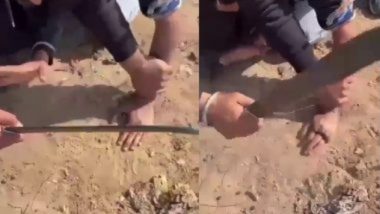 Cut Off Fingers In Mohali: धक्कादायक! पंजाबमध्ये तलवारीने कापली तरुणाची बोटं; काय आहे नेमकी प्रकरण? जाणून घ्या, Watch Video