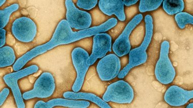 Marburg Virus: कोरोनानंतर आता आणखी एक जीवघेण्या विषाणूची दहशत, जाणून घ्या किती धोकादायक