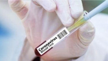 Coronavirus Updates: भारतात कोरोना व्हायरस संसर्गाचे 3,325 नवे संक्रमित; देशभरात सक्रीय रुग्णसंख्येचा आकडा 44,175 वर