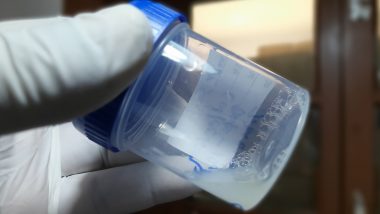 Court Orders Sperm Donor To Stop Donating: जागतिक स्तरावर 550 पेक्षा अधिक मुलांना जन्म देणाऱ्या व्यक्तीला डच कोर्टाने दिला वीर्य दान न करण्याचा आदेश; काय आहे नेमके प्रकरण? जाणून घ्या