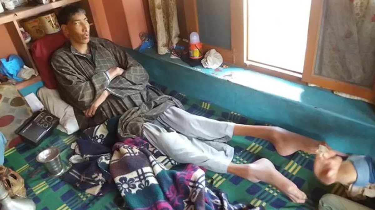 Kashmir News: कुपोषणामुळे काश्मीरमधील ‘सर्वात उंच व्यक्ती’चा 38 व्या वर्षी मृत्यू