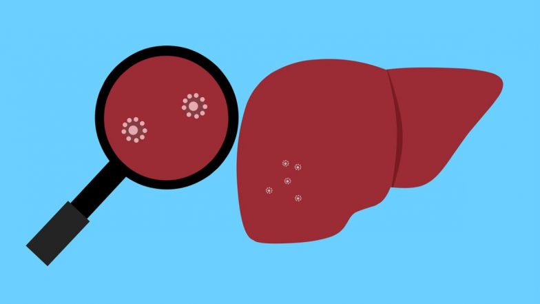 Hepatitis B Cases in Maharashtra: चिंताजनक! हिपॅटायटीस बी प्रकरणांमध्ये महाराष्ट्र देशात तिसऱ्या क्रमांकावर; गेल्या पाच वर्षांत समोर आली 31,128 प्रकरणे