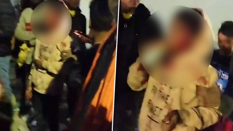 Viral Video: 12 वर्षाच्या मुलाने वाचवले मित्राचे प्राण, वाघांशी केली झुंज