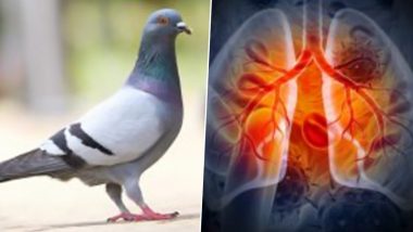 Pigeons Give You Deadly Lungs: सावधान! कबुतरांमुळे पसरत आहेत घातक आजार; महिलेला करावे लागले फुफ्फुसाचे प्रत्यारोपण