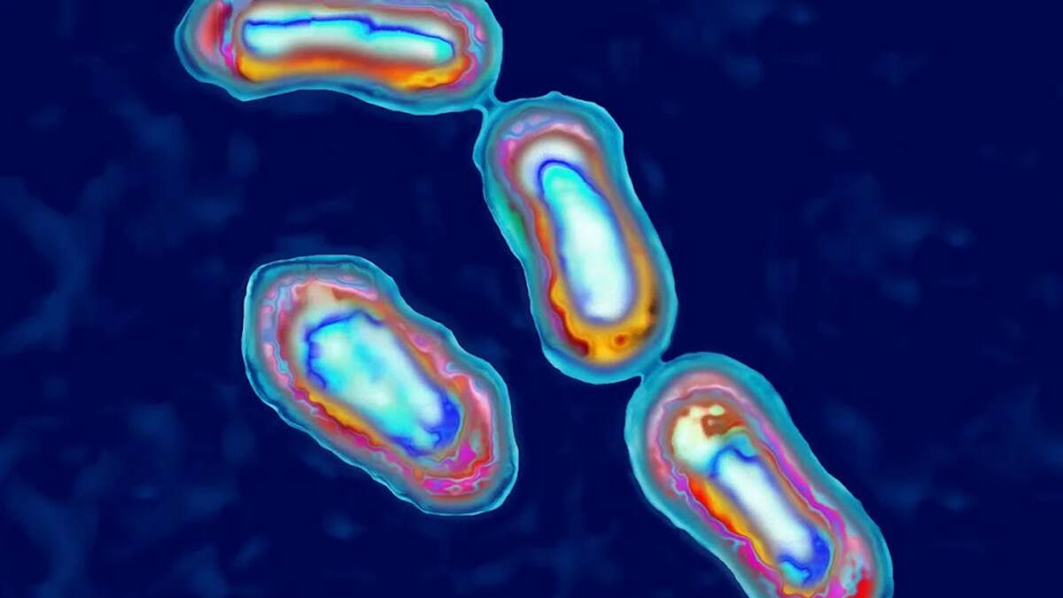 Human Plague Identified in Oregon: एका व्यक्तीला पाळीव प्राण्यामुळे झाला जीवघेणा आजार, जाणून घ्या अधिक माहिती