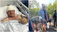 Leopard Attacked On Guy Whittall: झिम्बाब्वेचा माजी क्रिकेटपटू गाय व्हिटल याच्यावर बिबट्याचा हल्ला; थोडक्यात बचावला, रुग्णालयात दाखल