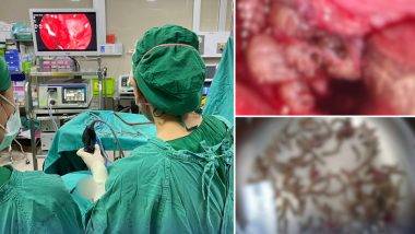 Maggots in Woman’s Nostrils: नाक बंद झाल्यामुळे महिला होती त्रस्त, डॉक्टरांनी तपासले तेव्हा दिसले शेकडो किडे