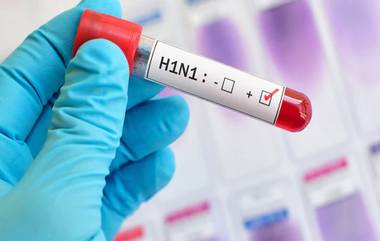 Maharashtra Swine Flu: महाराष्ट्रात स्वाईन फ्लूचा धोका वाढला, 432 रुग्ण पॉझिटिव्ह, 15 जणांचा मृत्यू